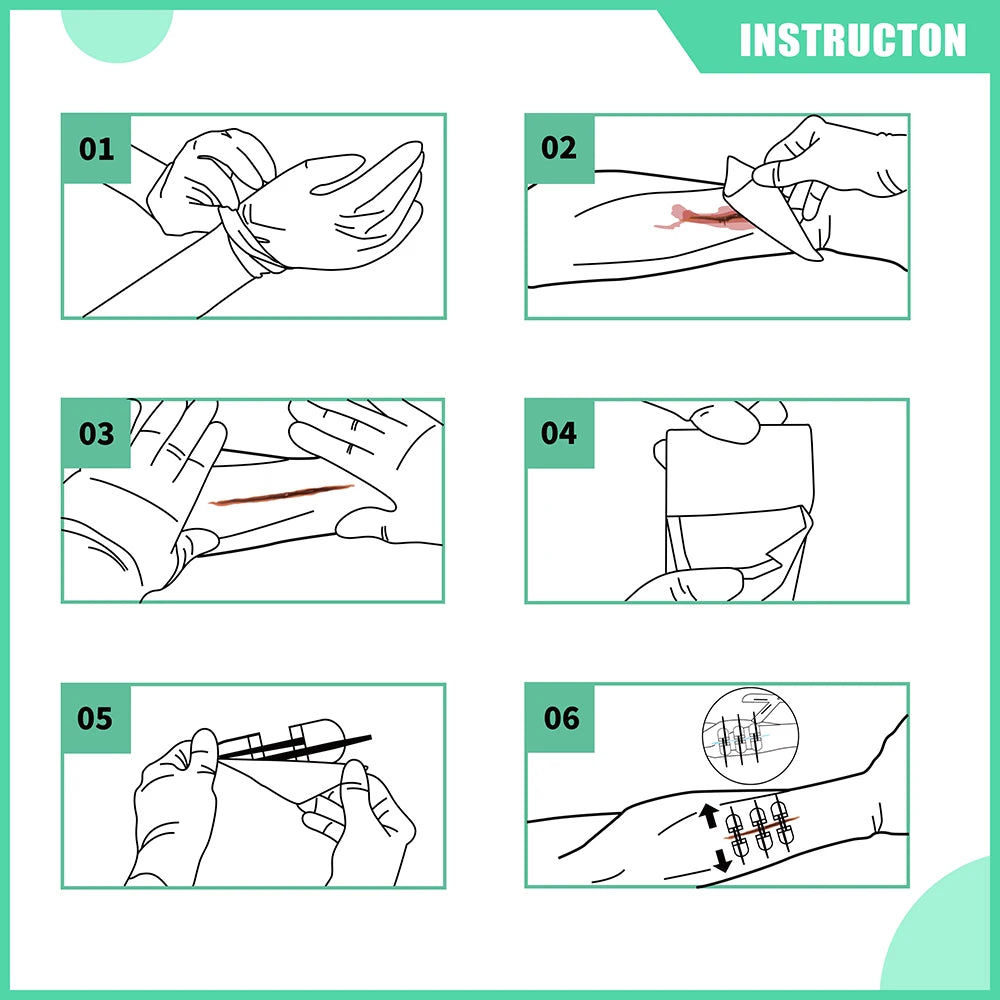 Zip Stitch 6Pcs with Wound Dresssings, Wound Closure Strips, Zipstitch Laceration Closure Kit for Cut Care Band-Aid